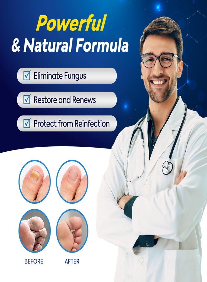 Tobcharm Toenail Fungus Treatment with 25% Undecylenic Acid, Toe Fungus Treatment for Toenail, Fungus Nail Treatment, Toenail Fungus Treatment Extra Strength, Fungal Nail Treatment for Athletes Foot - 2pcs - Image 2